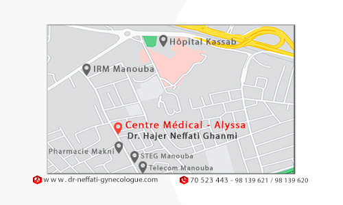 Carte Visite gynécologue tunisie